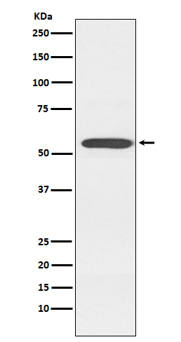 Cytochrome P450 2D6 Rabbit mAb