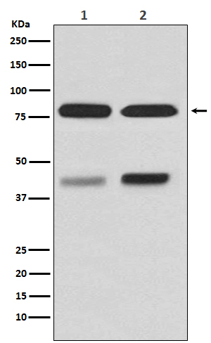 PKC beta 1 Rabbit mAb