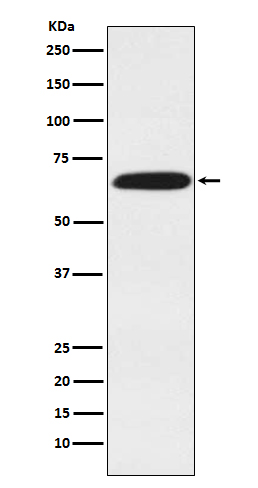 DDX5 Rabbit mAb