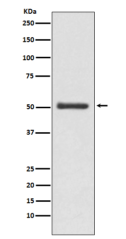 LOXL2 Rabbit mAb 