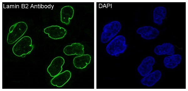 Lamin B2 Rabbit mAb