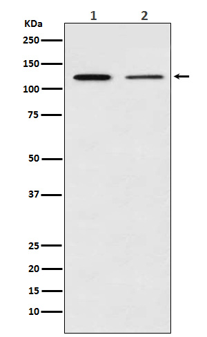 NFkB p100 / p52 Rabbit mAb