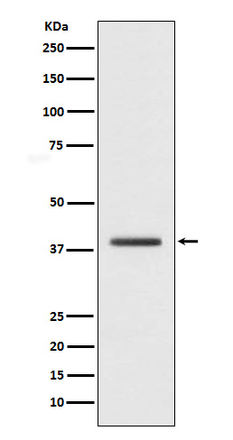 macroH2A.1 Rabbit mAb