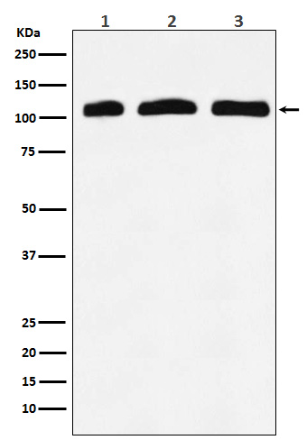 PI 3 Kinase p110 delta Rabbit mAb