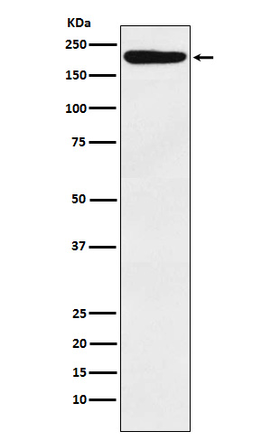 IQGAP1 Rabbit mAb