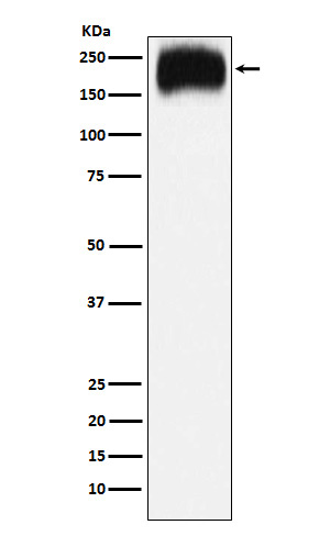 Niemann Pick C1 Rabbit mAb