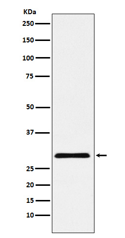 cbx7 Rabbit mAb