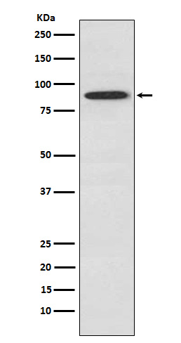 SAE2 / UBA2 Rabbit mAb