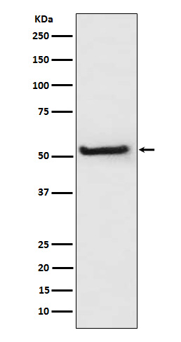 TXNIP Rabbit mAb