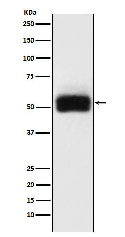 MMP17 Rabbit mAb