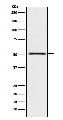 NR0B1 / DAX1 Rabbit mAb