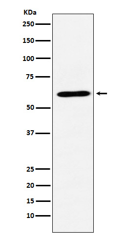 CRMP1 Rabbit mAb