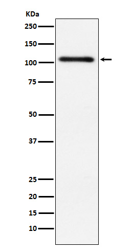 Protein Kinase D2 Rabbit mAb