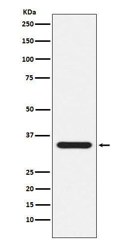 Presenilin 1 Rabbit mAb