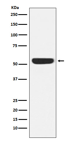 CAMKIV Rabbit mAb