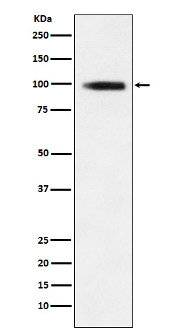 GIT1 Rabbit mAb