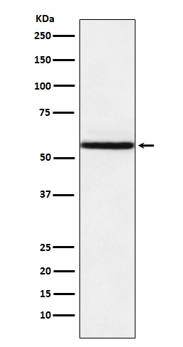 NR1D1 Rabbit mAb