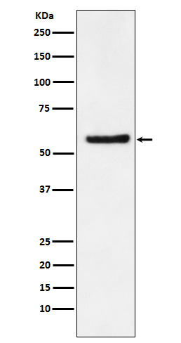 DKC1 Rabbit mAb