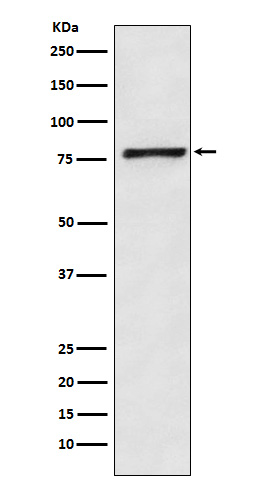 Fructose 6 Phosphate Kinase Rabbit mAb