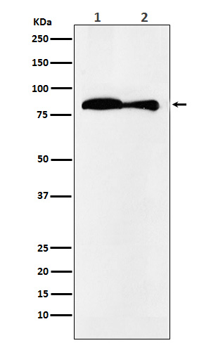 VPS35 Rabbit mAb