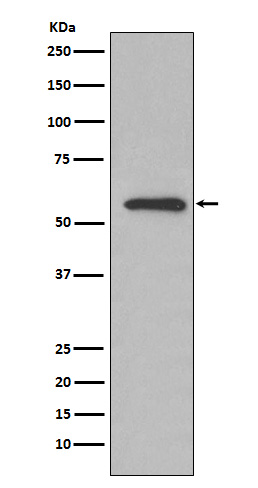 Glucose 6 phosphate isomerase Rabbit mAb