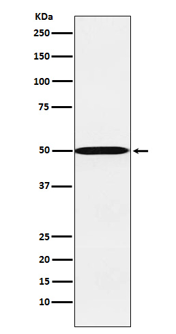 CYP26A1 Rabbit mAb