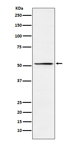 MEIS2 Rabbit mAb