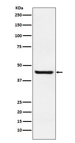 Septin 2 Rabbit mAb