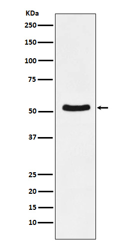 DDX6 Rabbit mAb