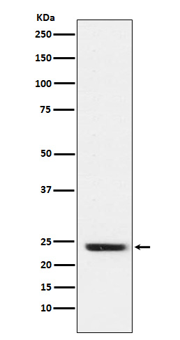 FNDC5 Rabbit mAb