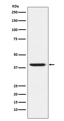 RING2 / RING1B / RNF2 Rabbit mAb