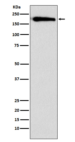 SMARCC1/BAF155 Rabbit mAb