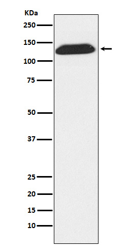 DNA Ligase I Rabbit mAb