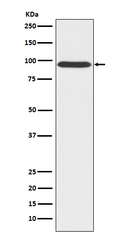 Gephyrin Rabbit mAb