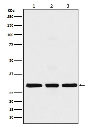 Histone H1.2 Rabbit mAb