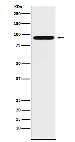 ALDH1L1 Rabbit mAb