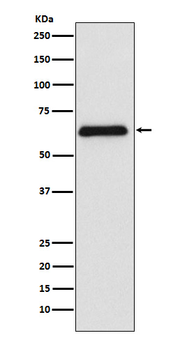 PARP2 Rabbit mAb