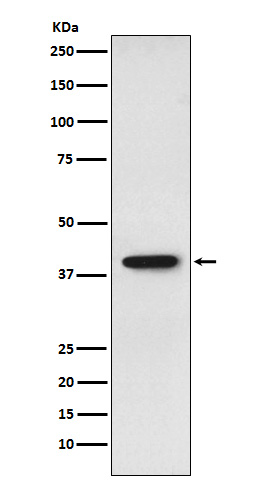 SET Rabbit mAb