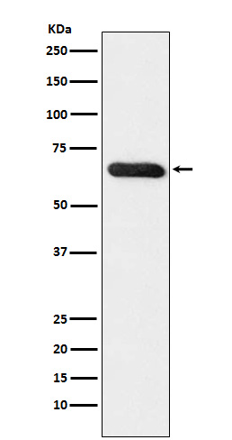 RBPJK Rabbit mAb