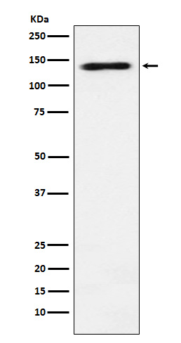 RNA Helicase A Rabbit mAb