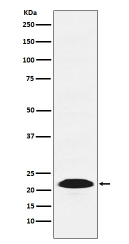 PSB9 / LMP2 Rabbit mAb