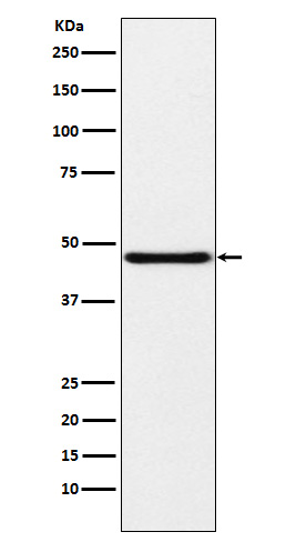 NPHS2 Rabbit mAb