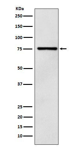 DCP1A Rabbit mAb