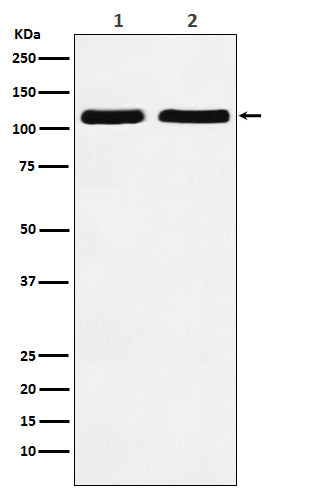 Nesprin 1 Rabbit mAb