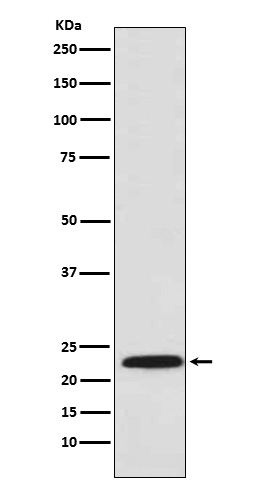 PSMB8 / LMP7 Rabbit mAb