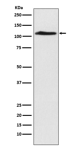 CHD1L Rabbit mAb