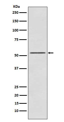 P70 S6 Kinase beta Rabbit mAb