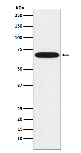 CYP1B1 Rabbit mAb