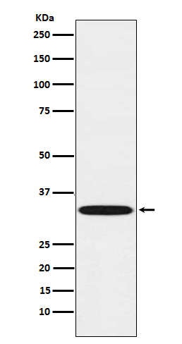 TREX1 Rabbit mAb