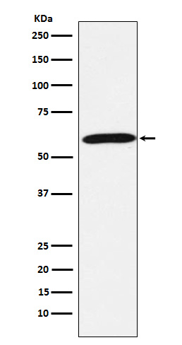 Calsequestrin 1 Rabbit mAb